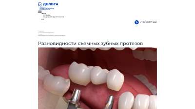 Съемный зубной протез 
